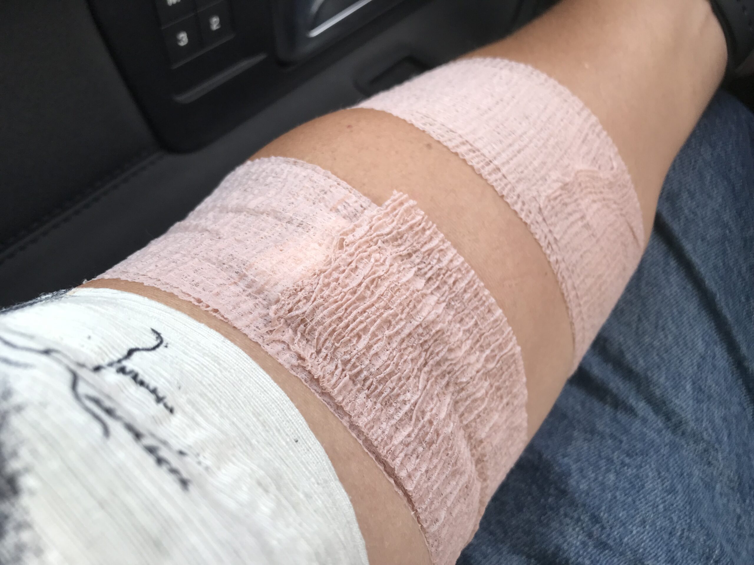 My Latest Adventure; The Oncologist